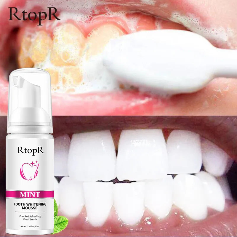 Teeth Whitening Oral Hygiene Whitening Mousse Tooth Stain Removal Dental Care Dental Products Oral Health Teeth Cleaning Beauty Essentials Toothpaste Whitening Stain Removal Dental Cosmetics Bright Smile Dental Hygiene Beauty Care