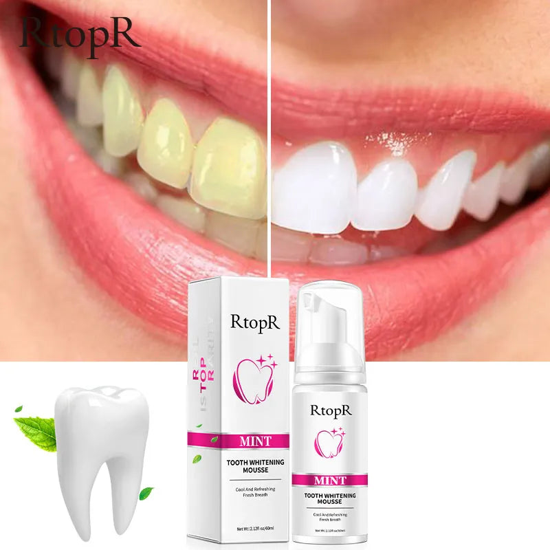 Teeth Whitening Oral Hygiene Whitening Mousse Tooth Stain Removal Dental Care Dental Products Oral Health Teeth Cleaning Beauty Essentials Toothpaste Whitening Stain Removal Dental Cosmetics Bright Smile Dental Hygiene Beauty Care