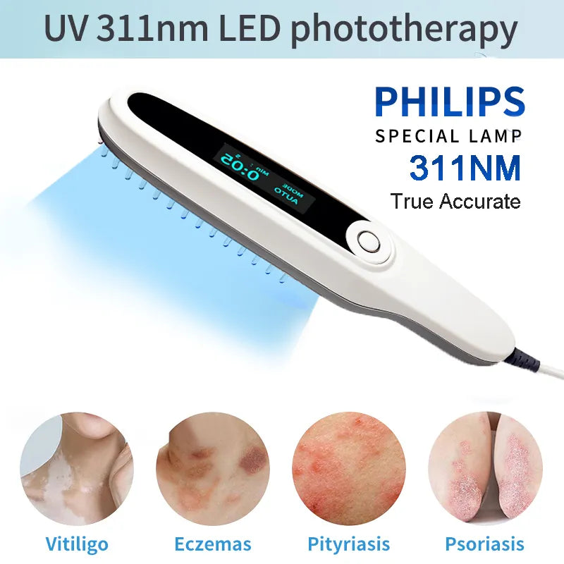 UVB Light Therapy Lamp Psoriasis Treatment Vitiligo Therapy Dermatitis Relief Eczema Treatment Rosea Therapy Pityriasis Treatment Skin Disease Solution Medical Lamp Dermatology Device Health Technology Skin Treatment Home Therapy Device UVB Treatment Lamp Dermatology Tool