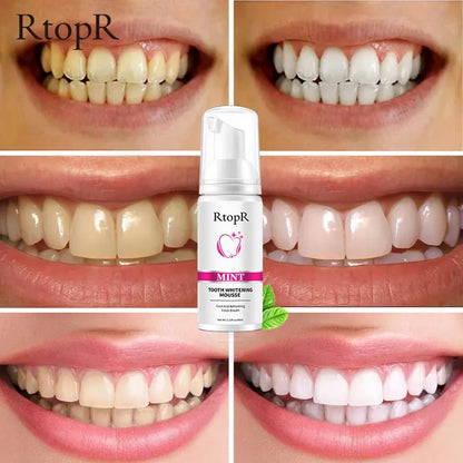 Teeth Whitening Oral Hygiene Whitening Mousse Tooth Stain Removal Dental Care Dental Products Oral Health Teeth Cleaning Beauty Essentials Toothpaste Whitening Stain Removal Dental Cosmetics Bright Smile Dental Hygiene Beauty Care